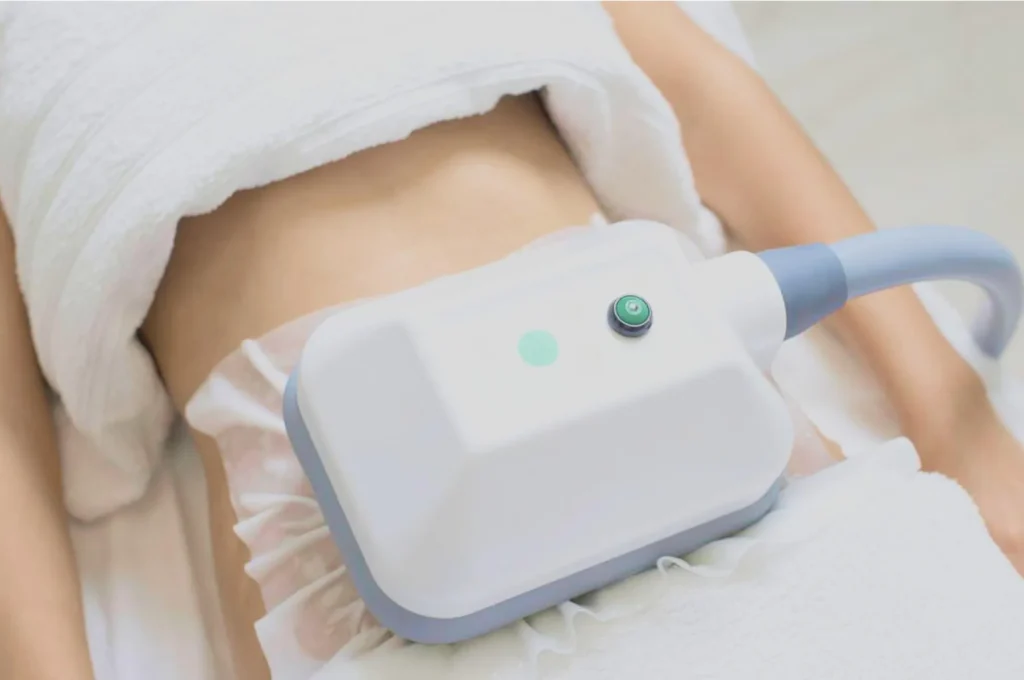 How Fat Freezing and HIFU Work Together? 3 advantages to combining Fat Freezing and HIFU Cardiff