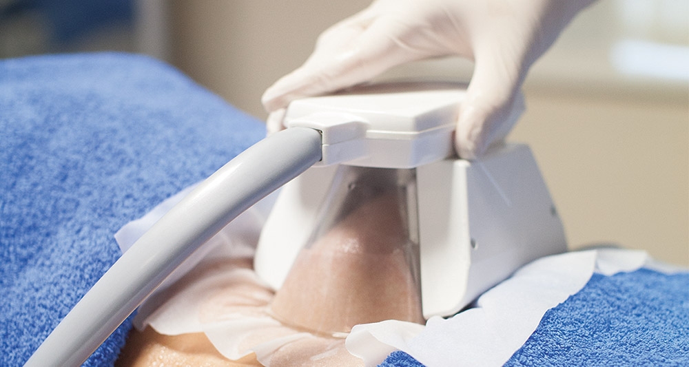 How Fat Freezing and HIFU Work Together? 2 Multiple Areas in One Session HIFU and Fat Freezing Cardiff