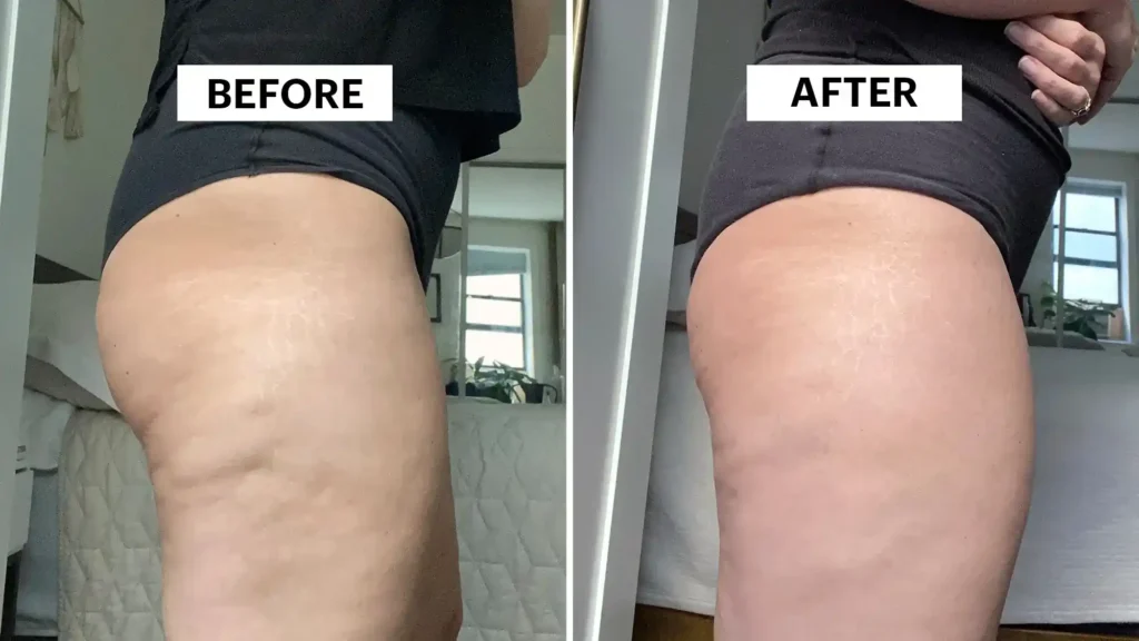 Do Toning Exercise Cardiff Really Tackle Cellulite?